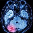 Brain scan