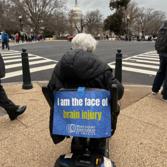 Woman on motorized scooter with a sign that says "I am the face of brain injury" attached