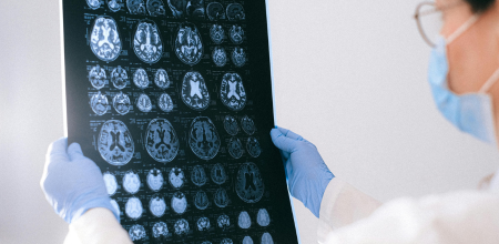 A doctor looking at a sheet of brain scans