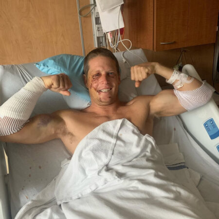 A white man with a buzz cut lays in a hospital bed. His arms are bandaged and he has scrapes on his face. He is flexing both of his arms and smiling.