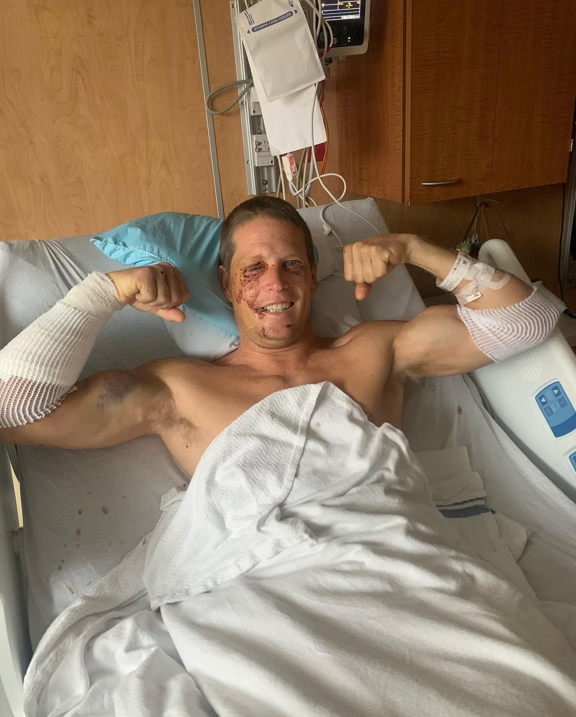 A white man with a buzz cut lays in a hospital bed. His arms are bandaged and he has scrapes on his face. He is flexing both of his arms and smiling.