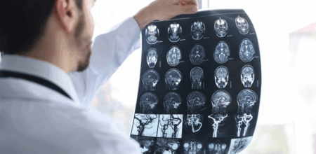 Doctor looking at a sheet of brain scans