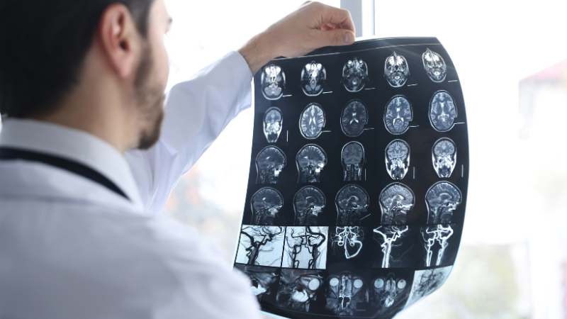 Doctor looking at a sheet of brain scans