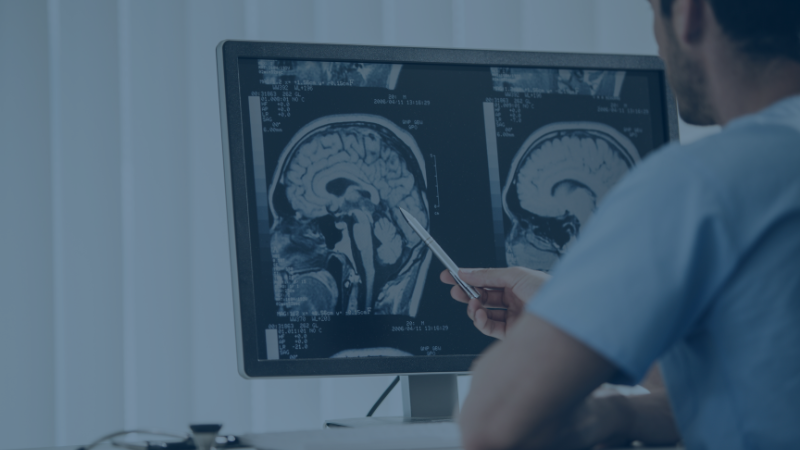 Medical professional reviewing a brain scan on a screen